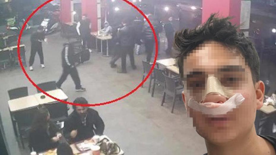 Antalya’da akran dehşeti! “Neden bakıyorsun” deyip burnunu kırdılar