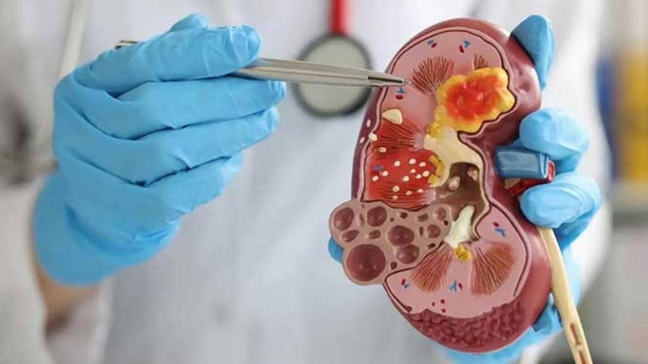 Çocuklarda ateşin nedeni böbrek olabilir: ‘Sessizce ilerliyor’