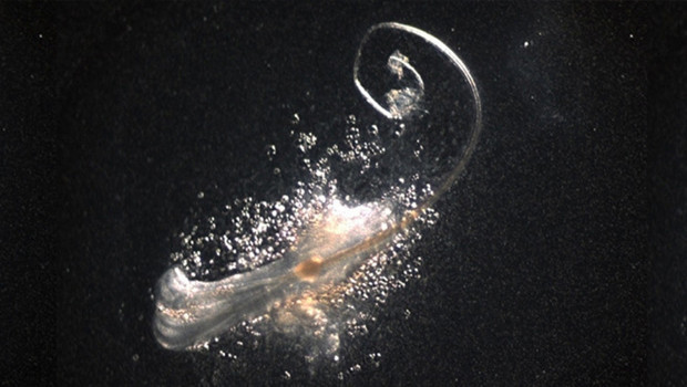 Saç dökülmesinde önemli gelişme: Laboratuvarda gerçek saç folikülleri üretildi!